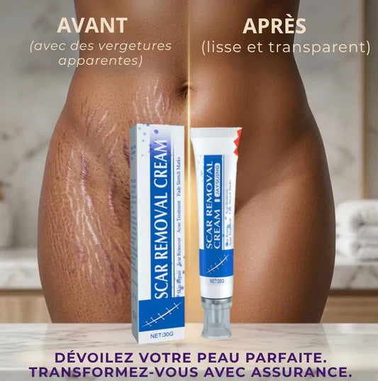 Crème Anti-Cicatrices et Vergeture